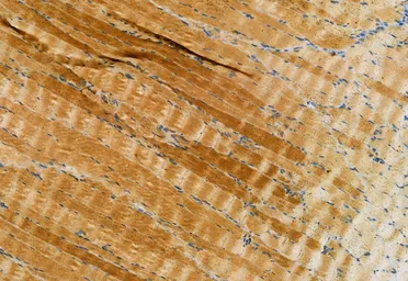 Anti-MLKL (phospho Ser358) antibody used in IHC (Paraffin sections) (IHC-P). GTX00973
