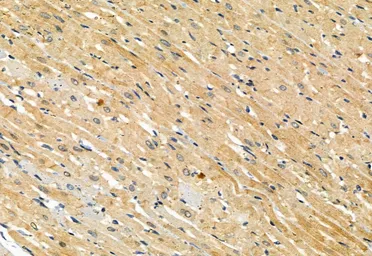 Anti-MLKL (phospho Ser358) antibody used in IHC (Paraffin sections) (IHC-P). GTX00973