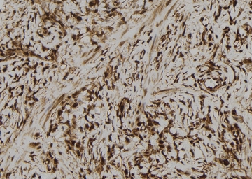 Anti-MLKL (phospho Ser358) antibody used in IHC (Paraffin sections) (IHC-P). GTX00973