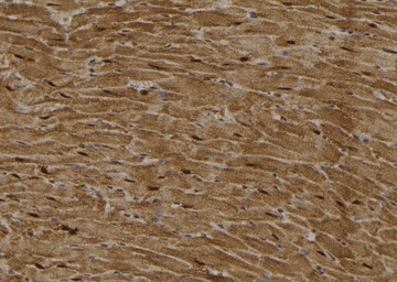 Anti-MLKL (phospho Ser358) antibody used in IHC (Paraffin sections) (IHC-P). GTX00973