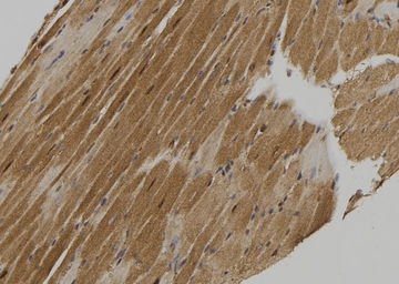 Anti-MLKL (phospho Ser358) antibody used in IHC (Paraffin sections) (IHC-P). GTX00973