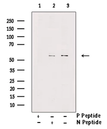 Anti-MLKL (phospho Ser358) antibody used in Western Blot (WB). GTX00973
