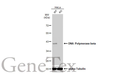 Anti-DNA polymerase beta antibody [JM93-12] used in Western Blot (WB). GTX00983