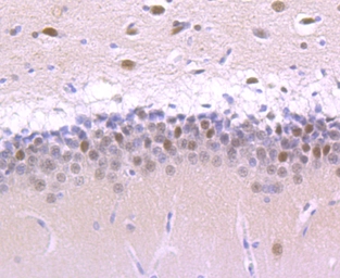 Anti-Cullin 1 antibody [JM72-30] used in IHC (Paraffin sections) (IHC-P). GTX00988