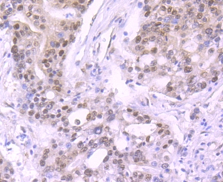 Anti-Cullin 1 antibody [JM72-30] used in IHC (Paraffin sections) (IHC-P). GTX00988
