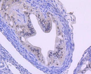 Anti-Cullin 1 antibody [JM72-30] used in IHC (Paraffin sections) (IHC-P). GTX00988