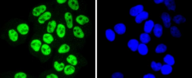 Anti-SP1 antibody [JF0950] used in Immunocytochemistry/ Immunofluorescence (ICC/IF). GTX01012