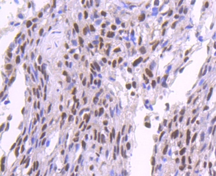 Anti-SP1 antibody [JF0950] used in IHC (Paraffin sections) (IHC-P). GTX01012