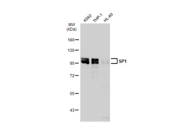 Anti-SP1 antibody [JF0950] used in Western Blot (WB). GTX01012