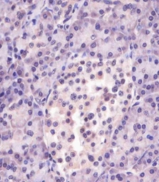 Anti-MGEA5 antibody used in IHC (Paraffin sections) (IHC-P). GTX01028