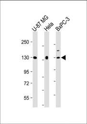 Anti-MGEA5 antibody used in Western Blot (WB). GTX01028