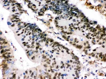 Anti-XRCC4 antibody used in IHC (Paraffin sections) (IHC-P). GTX01029
