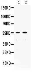 Anti-XRCC4 antibody used in Western Blot (WB). GTX01029