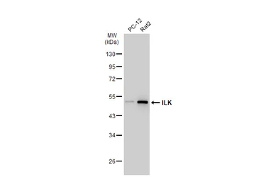 Anti-ILK antibody [SC68-04] used in Western Blot (WB). GTX01046