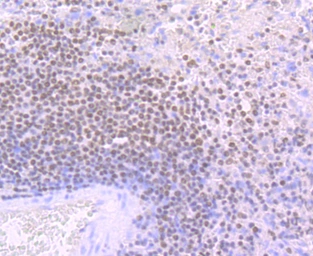Anti-Ikaros antibody [JB50-38] used in IHC (Paraffin sections) (IHC-P). GTX01051