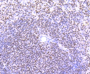 Anti-Ikaros antibody [JB50-38] used in IHC (Paraffin sections) (IHC-P). GTX01051