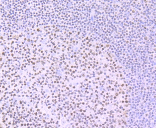Anti-Ikaros antibody [JB50-38] used in IHC (Paraffin sections) (IHC-P). GTX01051