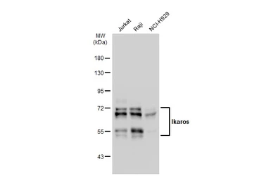 Anti-Ikaros antibody [JB50-38] used in Western Blot (WB). GTX01051
