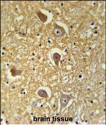 Anti-HAS2 antibody used in IHC (Paraffin sections) (IHC-P). GTX01068