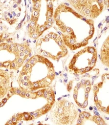 Anti-HAS2 antibody used in IHC (Paraffin sections) (IHC-P). GTX01068