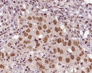 Anti-XRN2 antibody used in IHC (Paraffin sections) (IHC-P). GTX01072