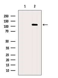 Anti-XRN2 antibody used in Western Blot (WB). GTX01072