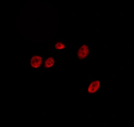Anti-SENP2 antibody used in Immunocytochemistry/ Immunofluorescence (ICC/IF). GTX01074