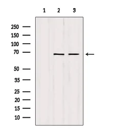 Anti-SENP2 antibody used in Western Blot (WB). GTX01074