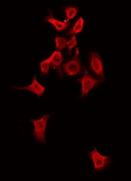 Anti-ALPK1 antibody used in Immunocytochemistry/ Immunofluorescence (ICC/IF). GTX01077