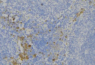 Anti-ALPK1 antibody used in IHC (Paraffin sections) (IHC-P). GTX01077