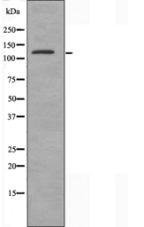Anti-ALPK1 antibody used in Western Blot (WB). GTX01077