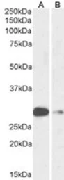 Anti-ASCL1 antibody used in Western Blot (WB). GTX01090