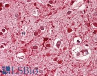 Anti-ASCL3 antibody used in IHC (Paraffin sections) (IHC-P). GTX01091