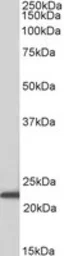 Anti-ASCL3 antibody used in Western Blot (WB). GTX01091