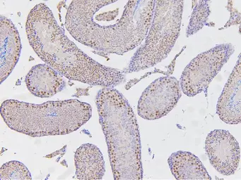 Anti-ARID2 antibody used in IHC (Paraffin sections) (IHC-P). GTX01135