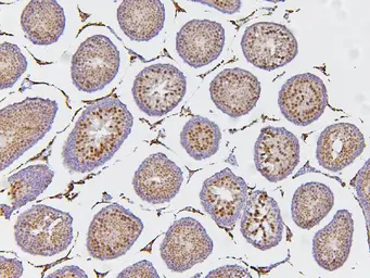 Anti-ARID2 antibody used in IHC (Paraffin sections) (IHC-P). GTX01135