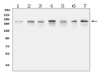 Anti-ARID2 antibody used in Western Blot (WB). GTX01135