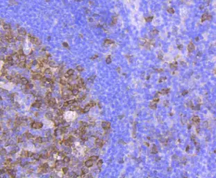 Anti-CDC2 antibody [SM01-44] used in IHC (Paraffin sections) (IHC-P). GTX01143