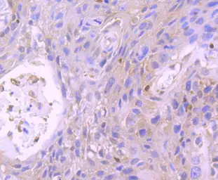 Anti-STAT5B antibody [SD08-08] used in IHC (Paraffin sections) (IHC-P). GTX01153