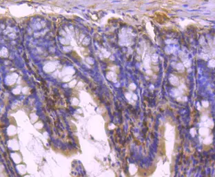 Anti-STAT5B antibody [SD08-08] used in IHC (Paraffin sections) (IHC-P). GTX01153