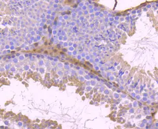 Anti-STAT5B antibody [SD08-08] used in IHC (Paraffin sections) (IHC-P). GTX01153