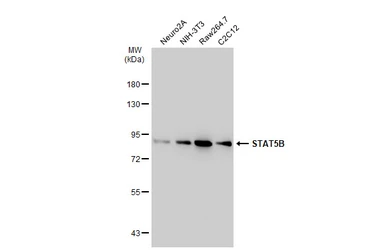Anti-STAT5B antibody [SD08-08] used in Western Blot (WB). GTX01153