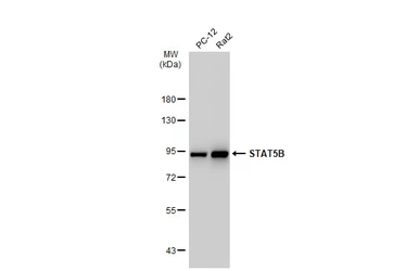 Anti-STAT5B antibody [SD08-08] used in Western Blot (WB). GTX01153