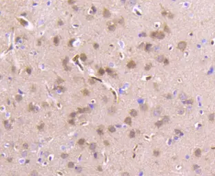 Anti-RKIP antibody [SC58-09] used in IHC (Paraffin sections) (IHC-P). GTX01163
