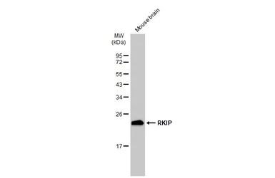 Anti-RKIP antibody [SC58-09] used in Western Blot (WB). GTX01163