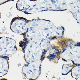 Anti-Bcl-2 antibody [GT1213] used in IHC (Paraffin sections) (IHC-P). GTX01194