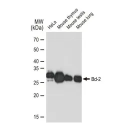 Anti-Bcl-2 antibody [GT1213] used in Western Blot (WB). GTX01194