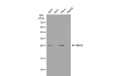 Anti-Bcl-2 antibody [GT1213] used in Western Blot (WB). GTX01194