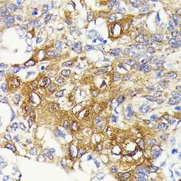Anti-IKK beta antibody [GT1216] used in IHC (Paraffin sections) (IHC-P). GTX01197