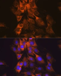 Anti-MEK1 antibody [GT1158] used in Immunocytochemistry/ Immunofluorescence (ICC/IF). GTX01293